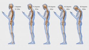 Diagram of humans looking at a phone, and their posture being stooped.