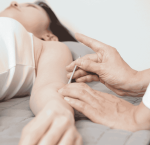 A Physiotherapist placing acupuncture needles into someone elbow